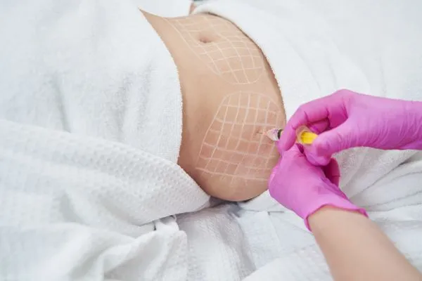image of fat dissolving injections on love handles to help combat weight gain Harpenden