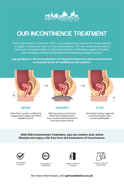 image to show how EMS treatment works for female urinary incontinence Harpenden